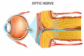 optic nerve atrophy and its homoeopathic treatment